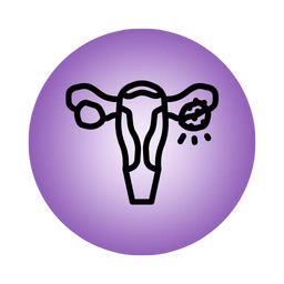 Ovarian Cysts Treatment in Hyderabad